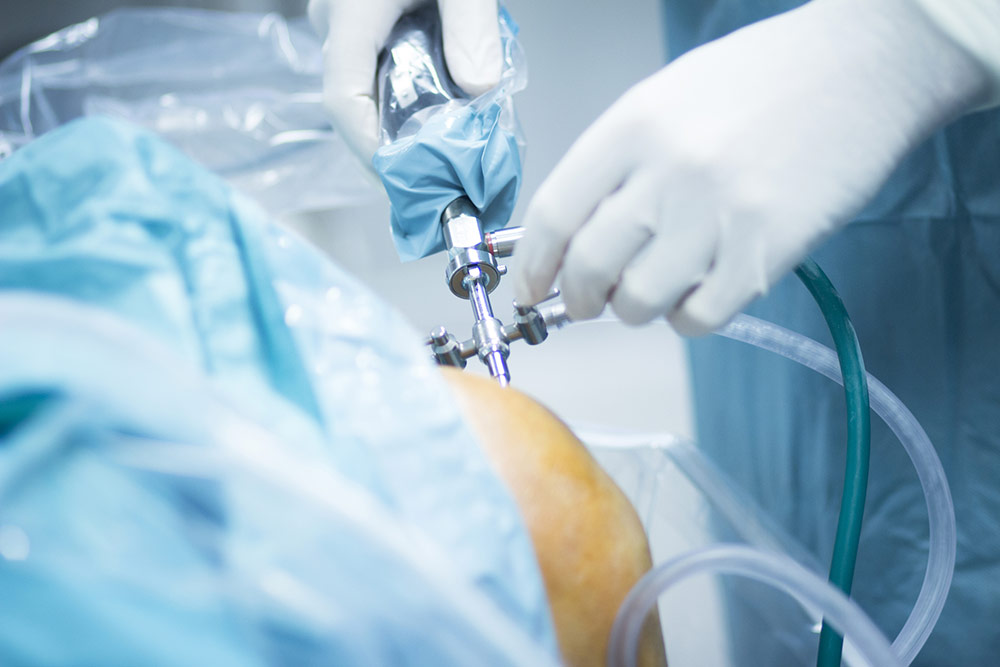 minimally invasive knee replacement in panvel minimally invasive knee replacement in panvel